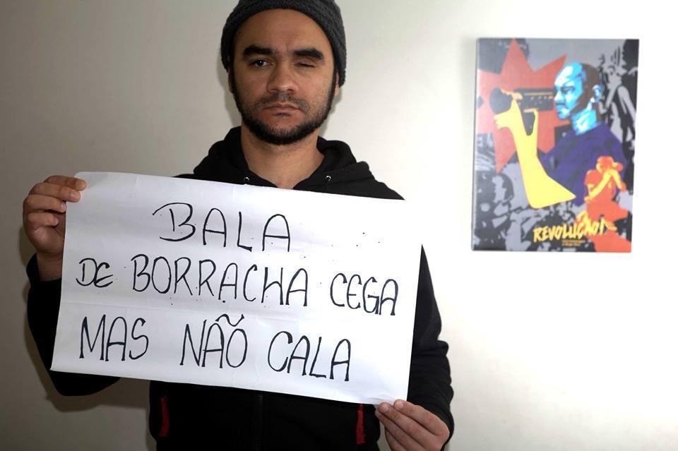 Fotógrafo ferido pela PM lança exposição temática